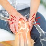 膝蓋痛1招自治療法，膝蓋滑膜炎、骨性關節炎、半月板損害都合理