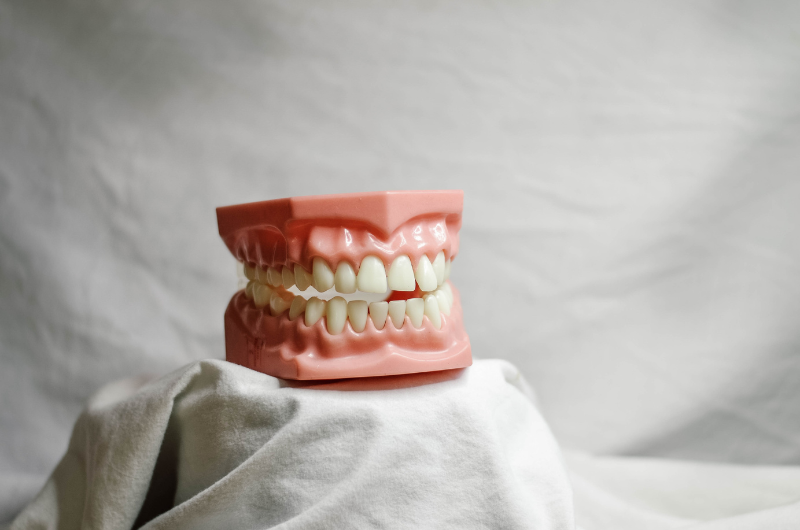揭開牙周病治療的神秘面紗：剝牙的奇妙功效